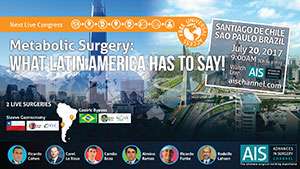 Metabolic Surgery: What Latin America has to say!